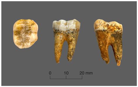 measurement of tooth enamel thickness|enamel forming cells are called.